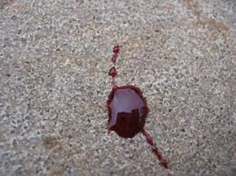 how to clean blood out of a carpet